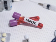 Η «mpox» δεν είναι η νέα covid